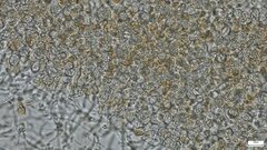 Phaeotremella fimbriata