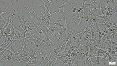 Phaeotremella fimbriata