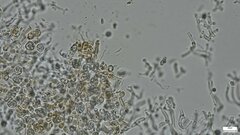 Phaeotremella fimbriata