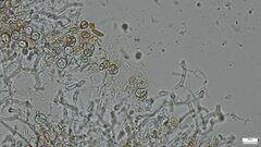 Phaeotremella fimbriata