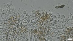 Phaeotremella fimbriata