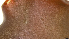Phaeotremella fimbriata