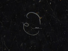 Nematoda