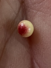 Zopheroteras sphaerula