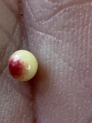 Zopheroteras sphaerula