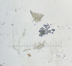Podospora collapsa
