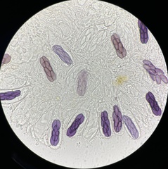 Saccobolus depauperatus
