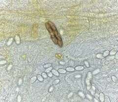 Saccobolus depauperatus