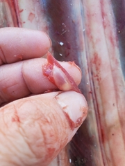 Cestoda