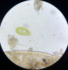 Paramecium bursaria