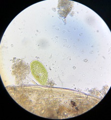 Paramecium bursaria