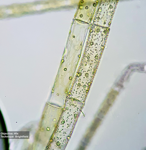 Oedogonium