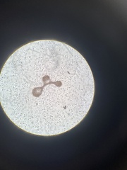 Microcystis