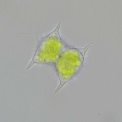 Staurodesmus dejectus