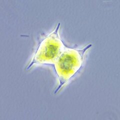 Staurodesmus dejectus