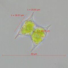 Staurodesmus dejectus