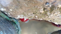 Actinia mediterranea