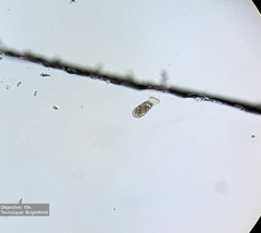 Spathidium