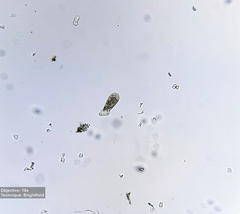 Spathidium