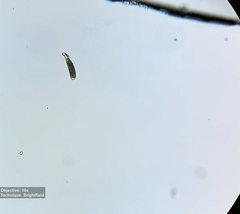 Spathidium