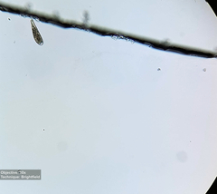 Spathidium