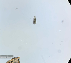 Spathidium