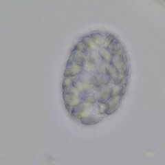 Euglenozoa