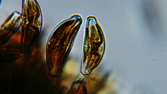 Cymbella