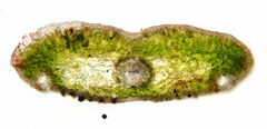Nothophaeocryptopus gaeumannii