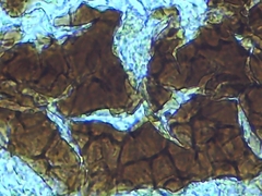 Erysiphe liriodendri