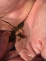 Gasterosteus aculeatus