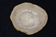 Patella vulgata