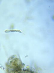 Gastrotricha