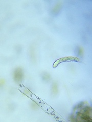 Gastrotricha