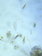 Gastrotricha
