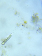Gastrotricha