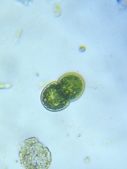 Cosmarium subcucumis