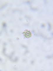 Heliozoa