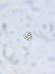 Heliozoa