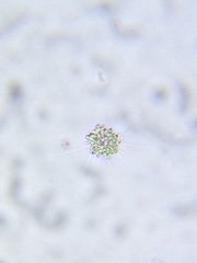 Heliozoa