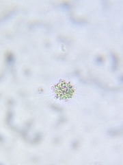 Heliozoa