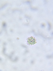 Heliozoa