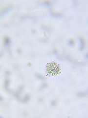 Heliozoa