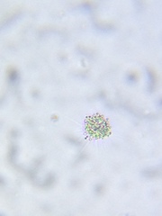 Heliozoa