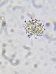Heliozoa