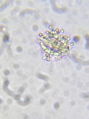 Heliozoa