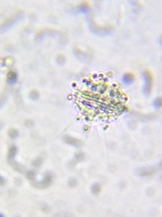 Heliozoa