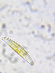 Cymbella
