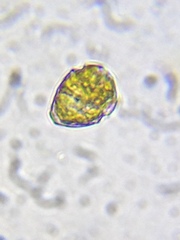 Parvodinium inconspicuum