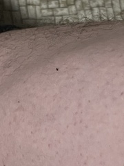 Siphonaptera